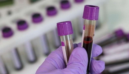 Scientists Develop Revolutionary Blood Test To Detect Diabetic Complications Early, Accurately