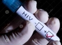 Scientists In US Identified First New HIV-1 Strain In 19 Years
