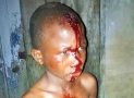 Court Remands Mother Of Blood-Soaked Boy In Custody