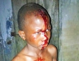 Lagos Rescues 12-Year-Old Boy From Parental Assault