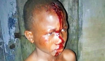 Court Remands Mother Of Blood-Soaked Boy In Custody