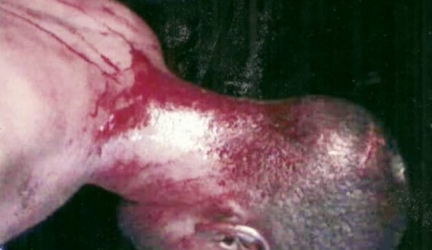 Bloodbath In Lagos As Armed Thugs Invade Lagos Community